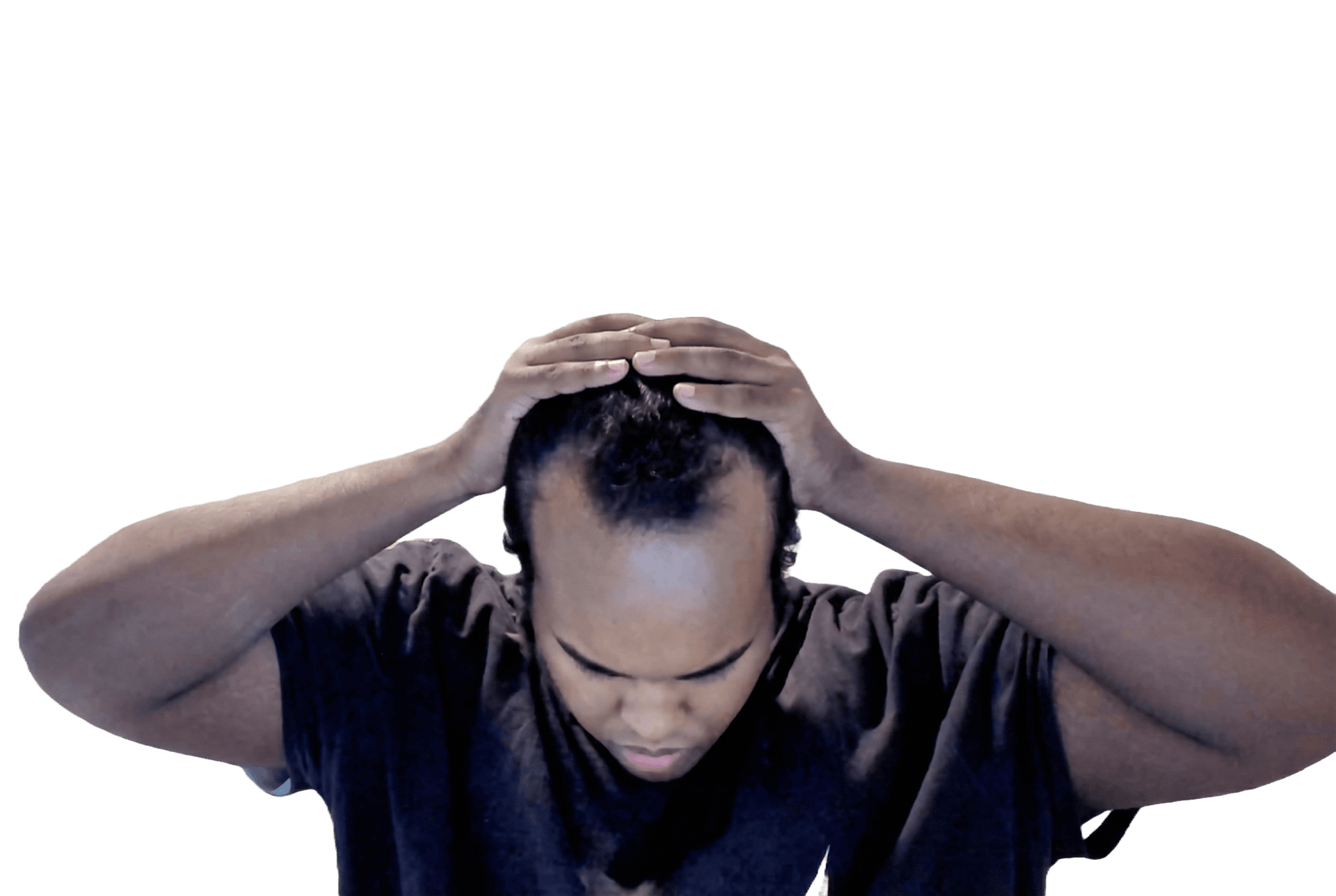 The Follicle Chronicle